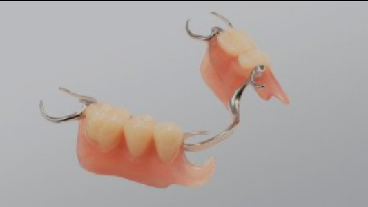 METAL FLEXIBLE PARTIAL DENTURES